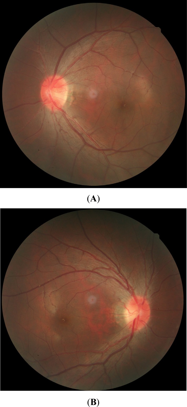 Fig. (1)