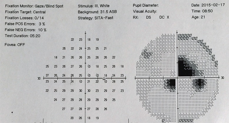 Fig. (2)