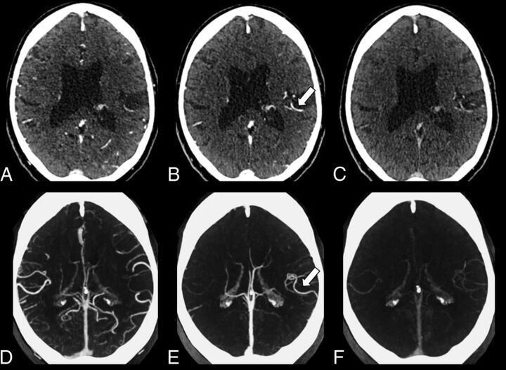 Fig 3.