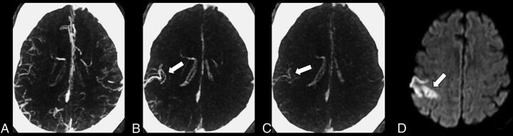 Fig 2.