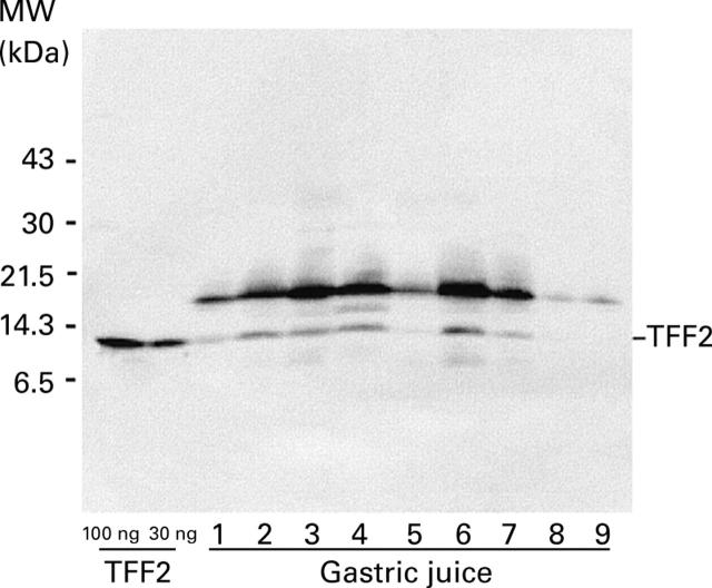 Figure 2  