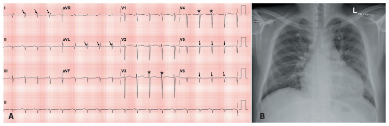 Figure 1: