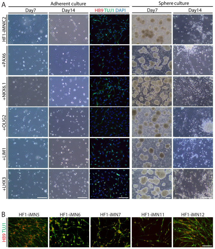 Figure 1—figure supplement 4.