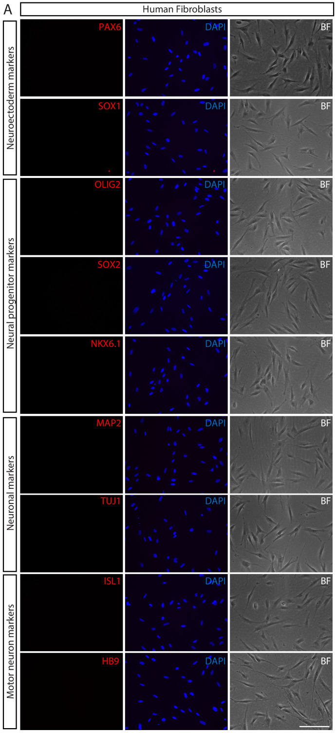 Figure 1—figure supplement 1.