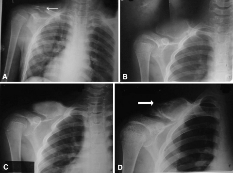 Fig. 2A–D