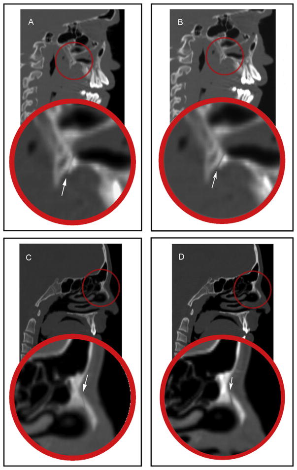 Fig 5