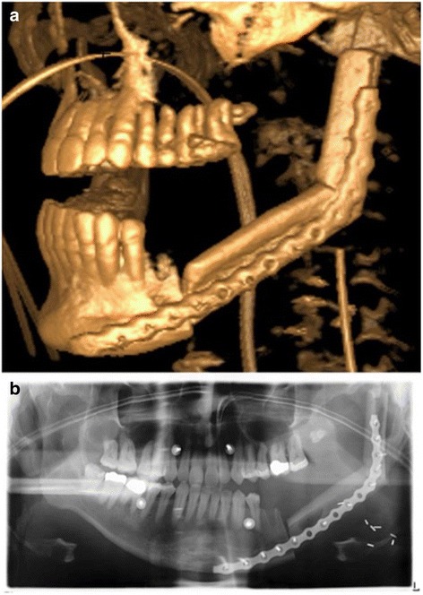 Fig. 13