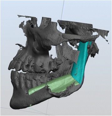 Fig. 11