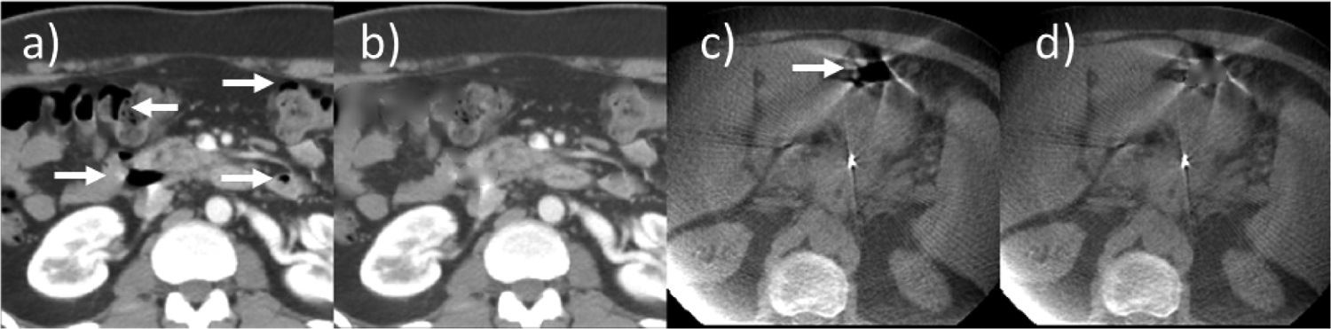 Figure 2: