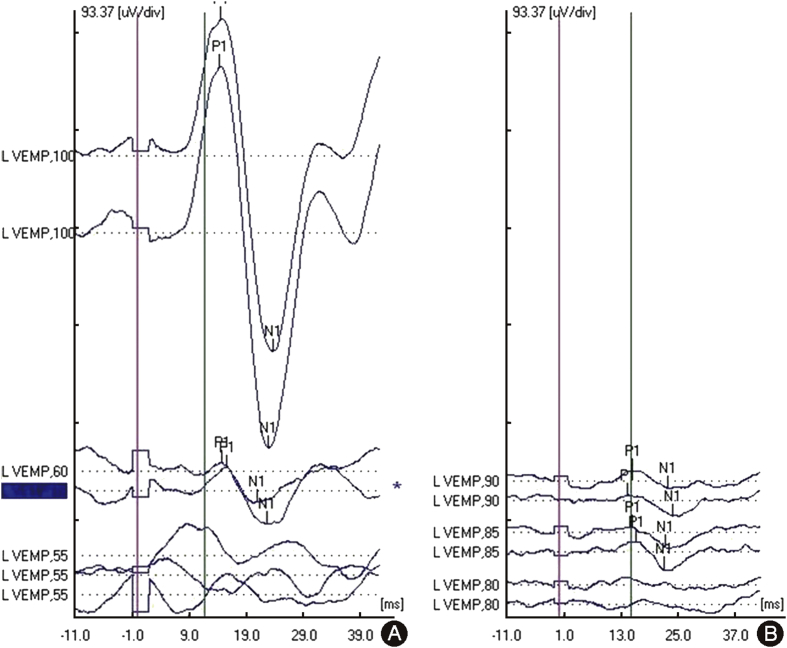 Fig. 1