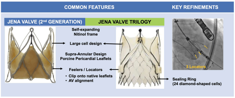 Novel features in the JenaValve second generation versus the JenaValve Trilogy.