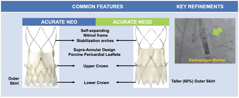 Novel features in the ACCURATE neo versus the ACCURATE neo2 transcatheter heart valves.