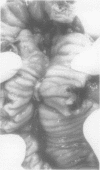 382