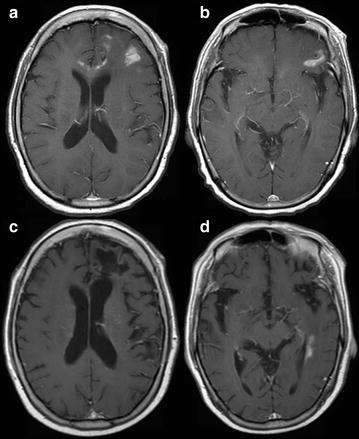 Fig. 1