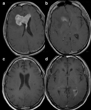 Fig. 2