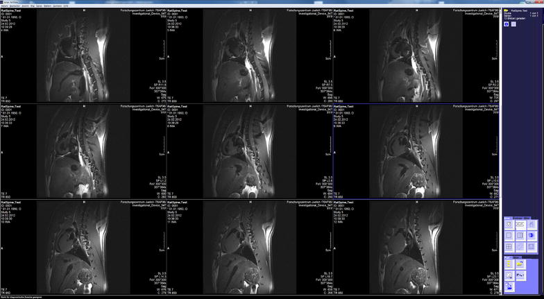 Fig. 6