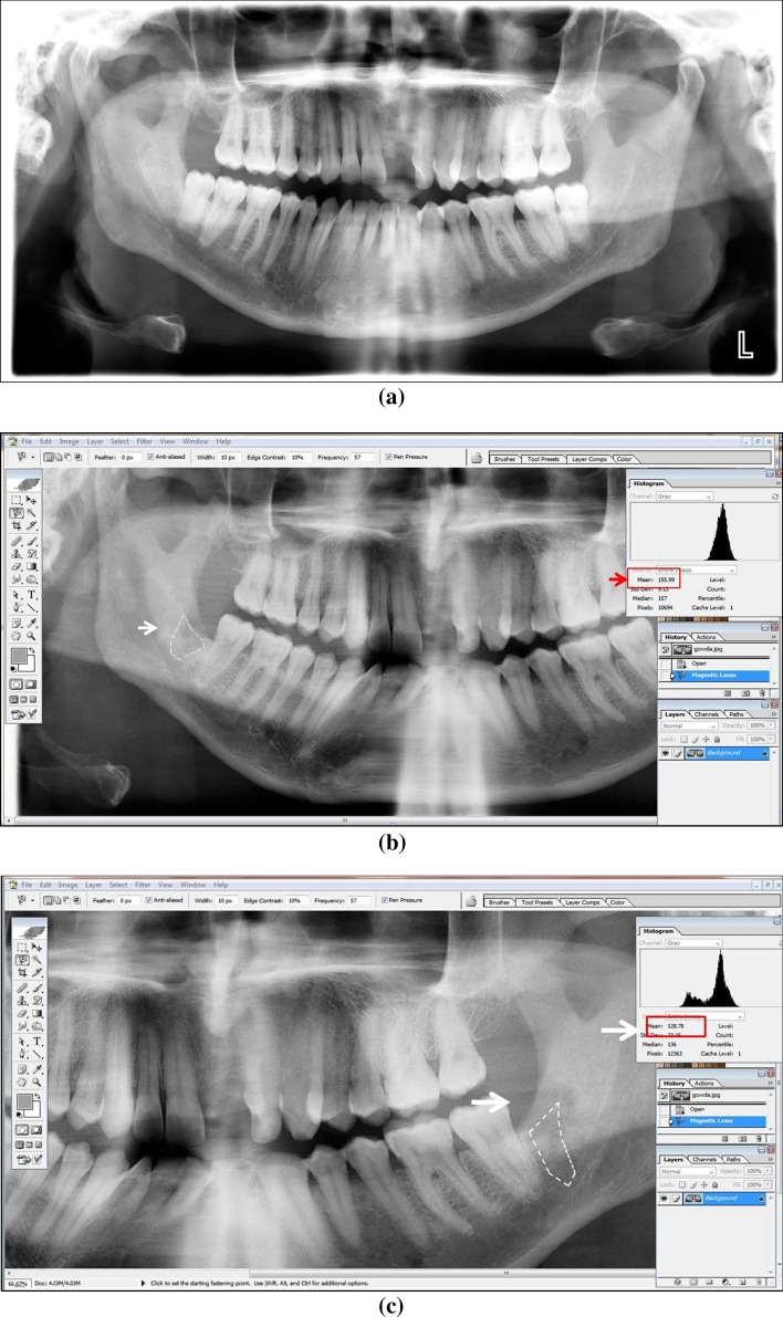 Fig. 3