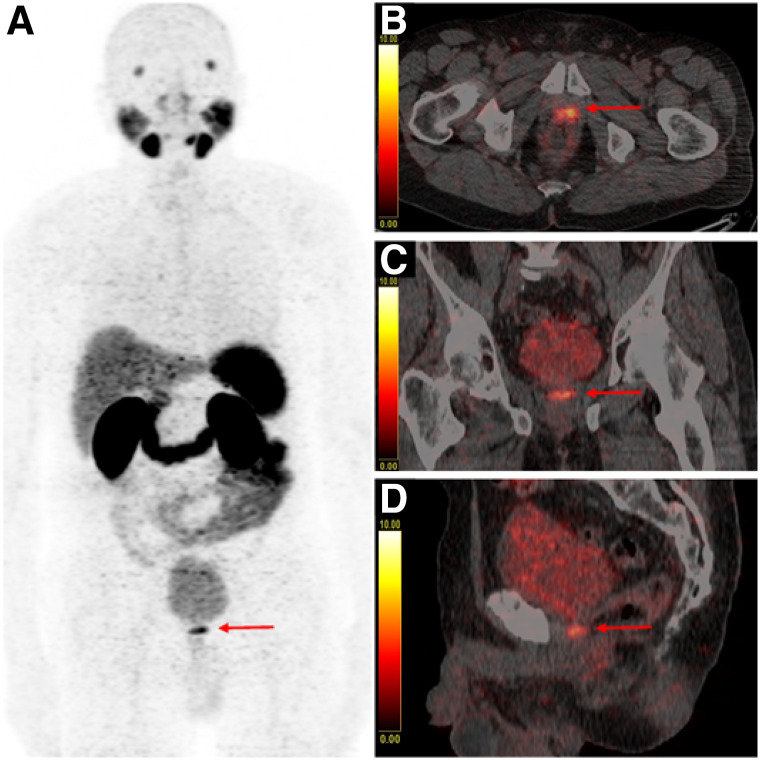 FIGURE 3.