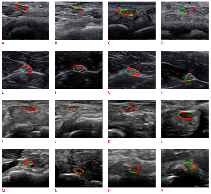 Fig. 4.