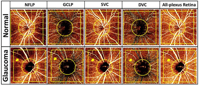 Figure 13.