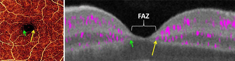 Figure 11.