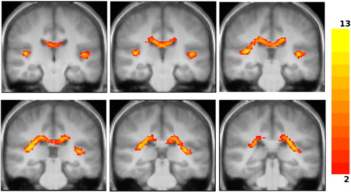 Fig. 10