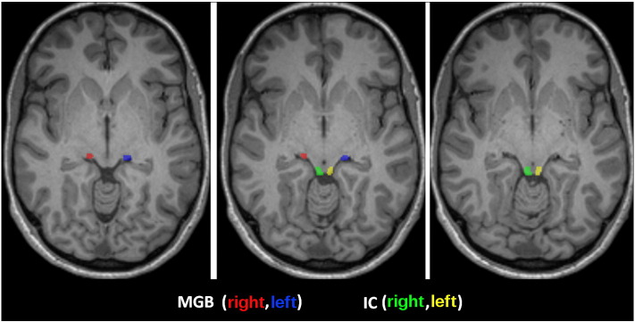 Fig. 4