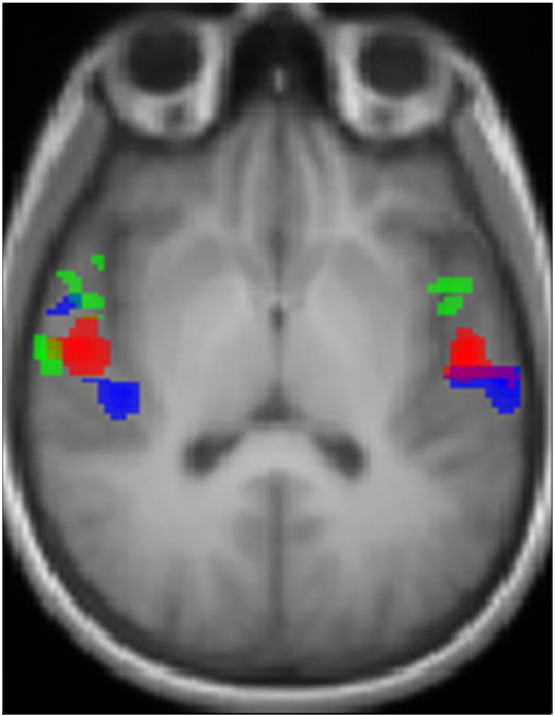 Fig. 2