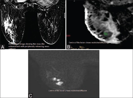 Figure 10 (A-C)