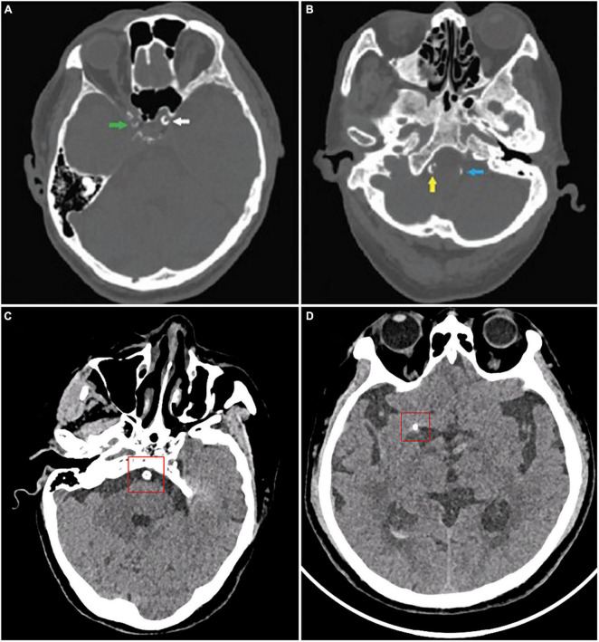 FIGURE 2