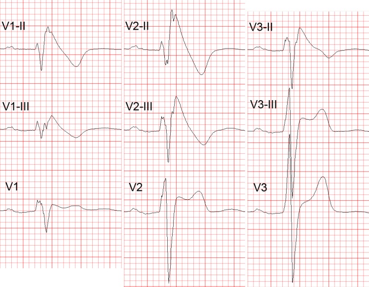 Figure 2: