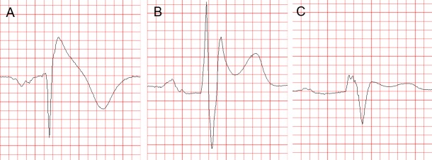 Figure 1: