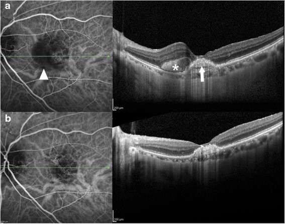 Fig. 2