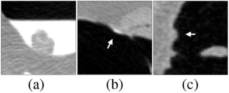 Fig. 10