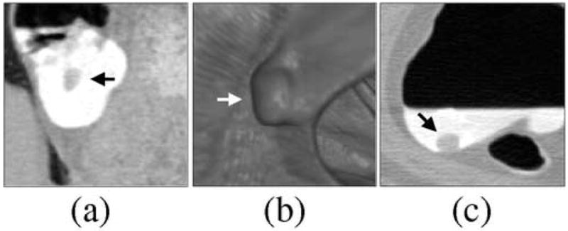 Fig. 11