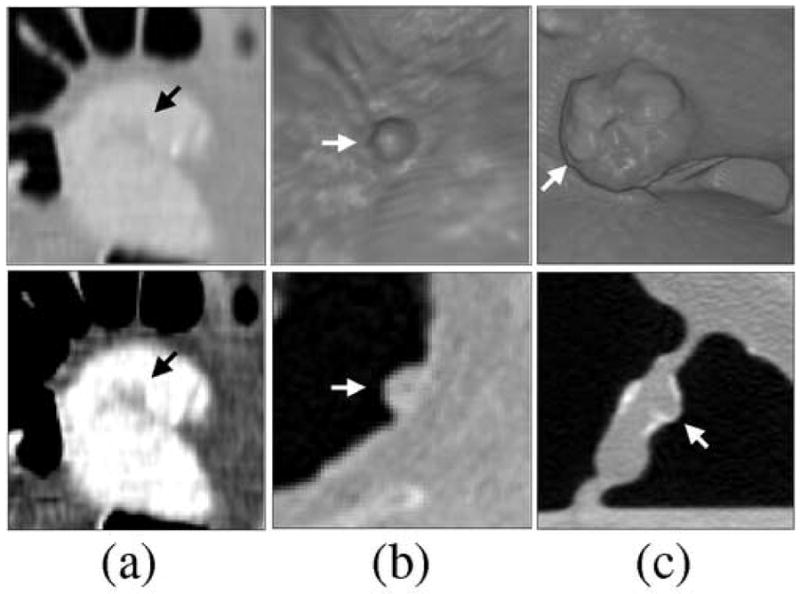 Fig. 12