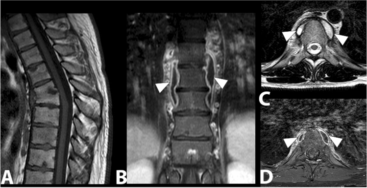 Fig. 11