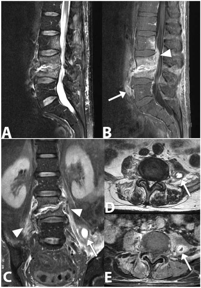 Fig. 10