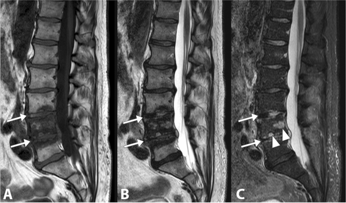 Fig. 14