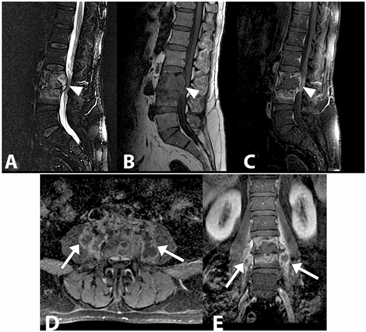 Fig. 12