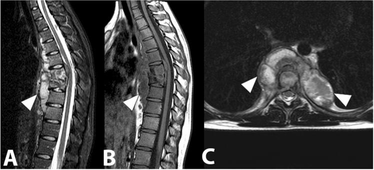 Fig. 13