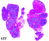 Figure 177.