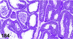 Figure 184.