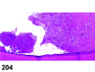 Figure 204.