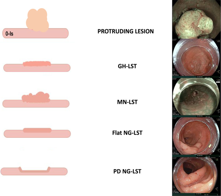 APPENDIX A.