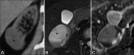 Figure 2 (A-C)
