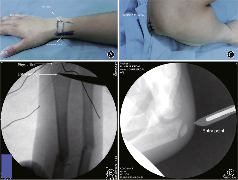 Fig. 2