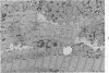 91