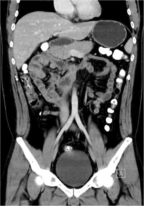 Fig. 13