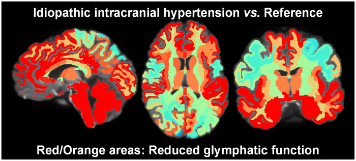 Graphical Abstract